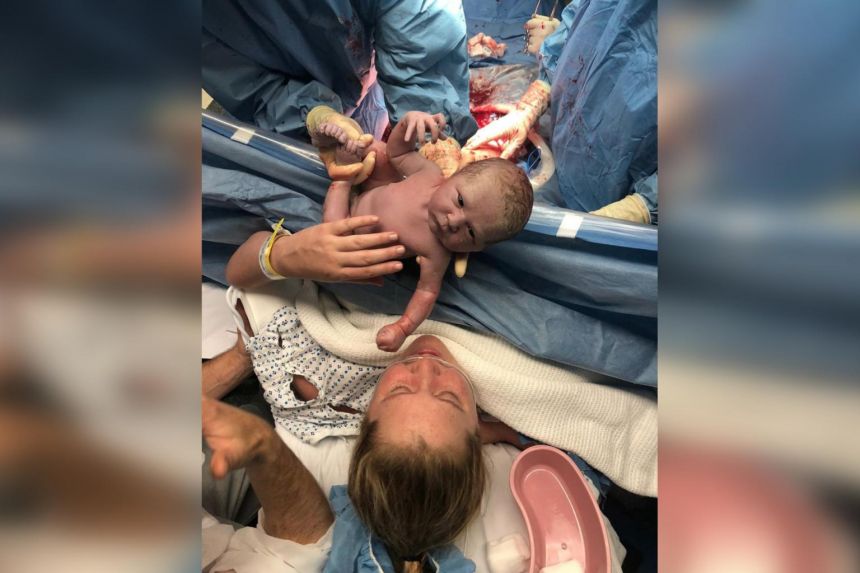 Actress Amy Schumer shares graphic photo of son's birth on National Bikini Day