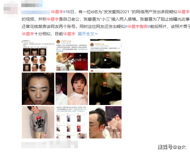 华晨宇整容风波后首露面，身形消瘦裤腿显宽松
