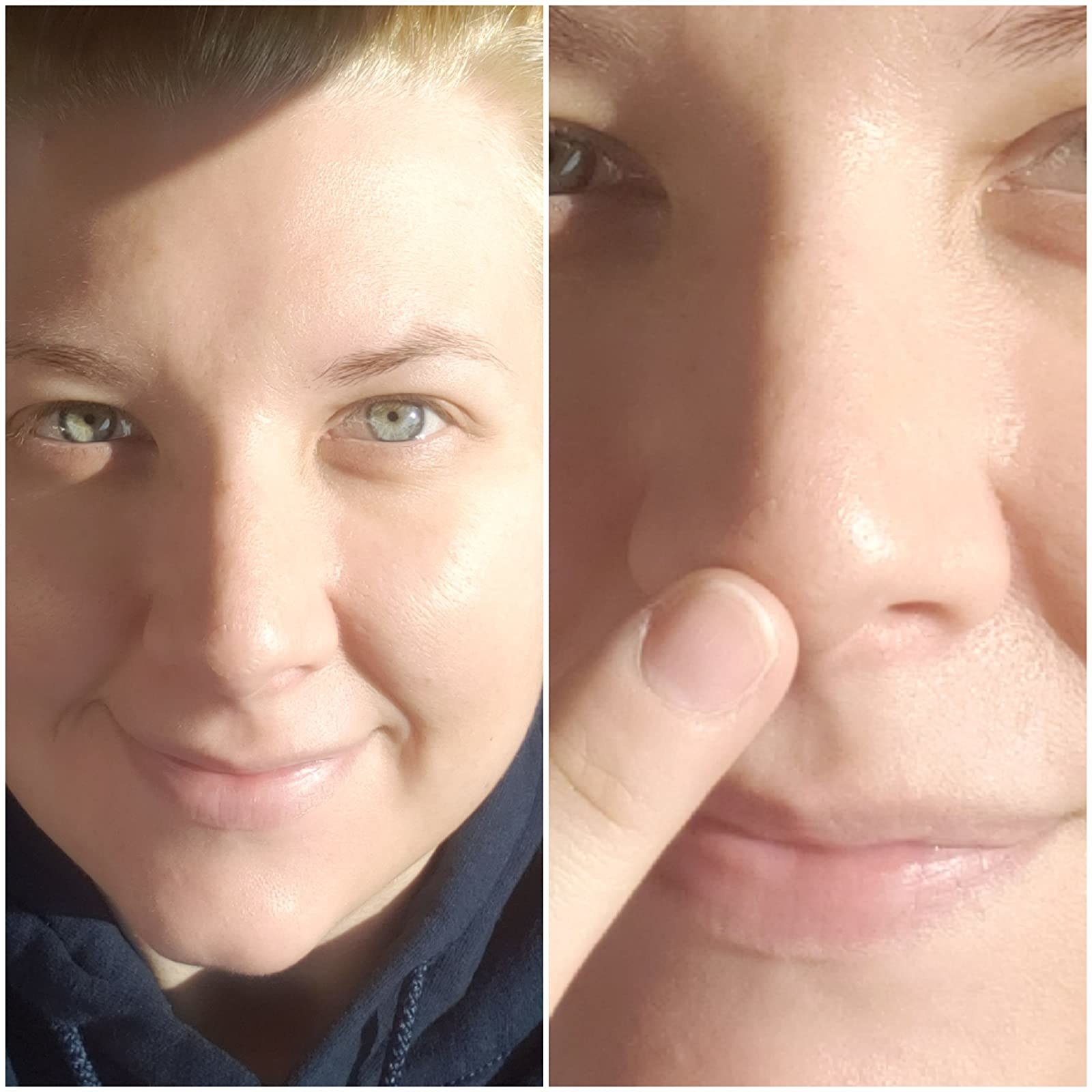 19 Pimple Patches To Effortlessly Clear Up Your Skin