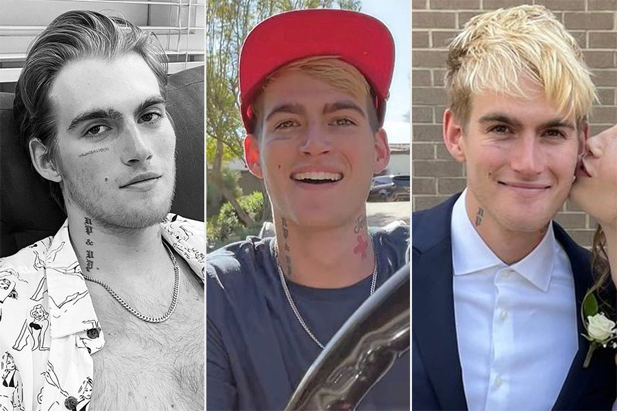 Presley Gerber May Have Removed His Face Tattoo — Here's What to Know About the Procedure