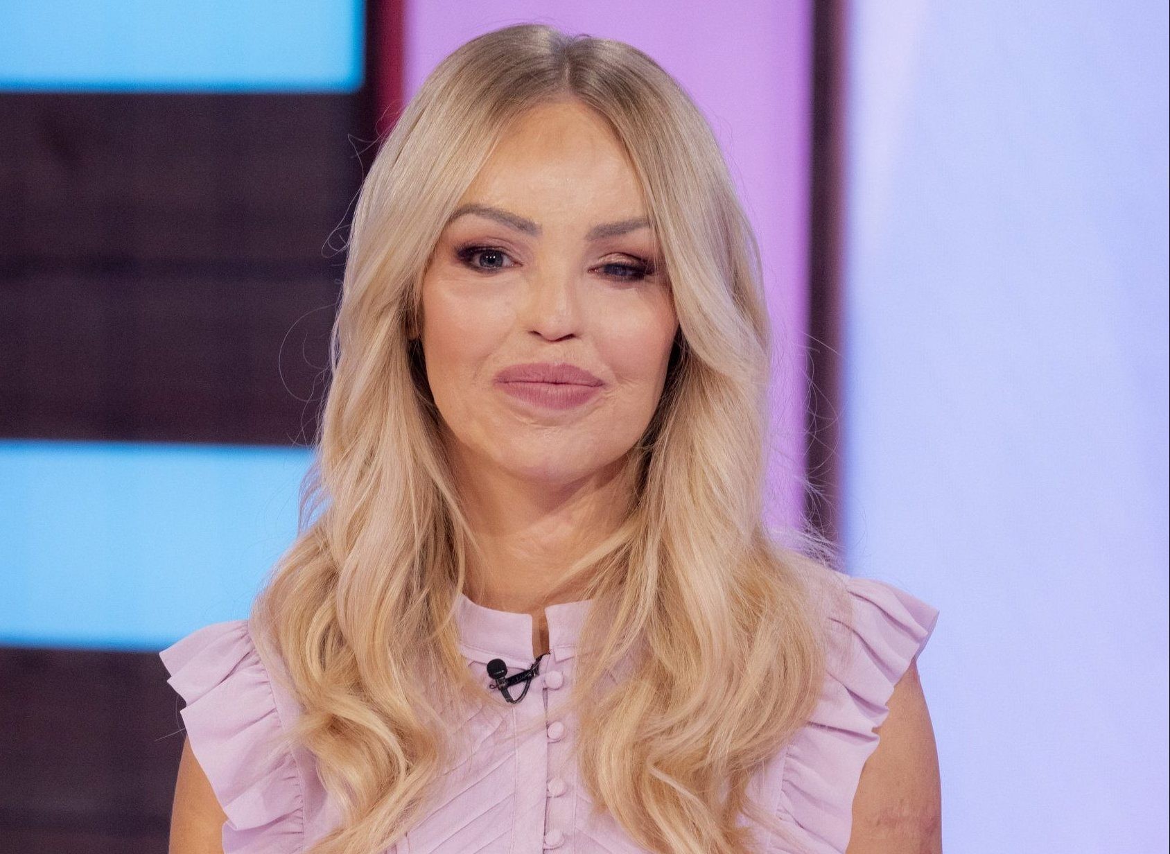 Katie Piper shares powerful message as she hits back at troll who claims she has ‘designer face’