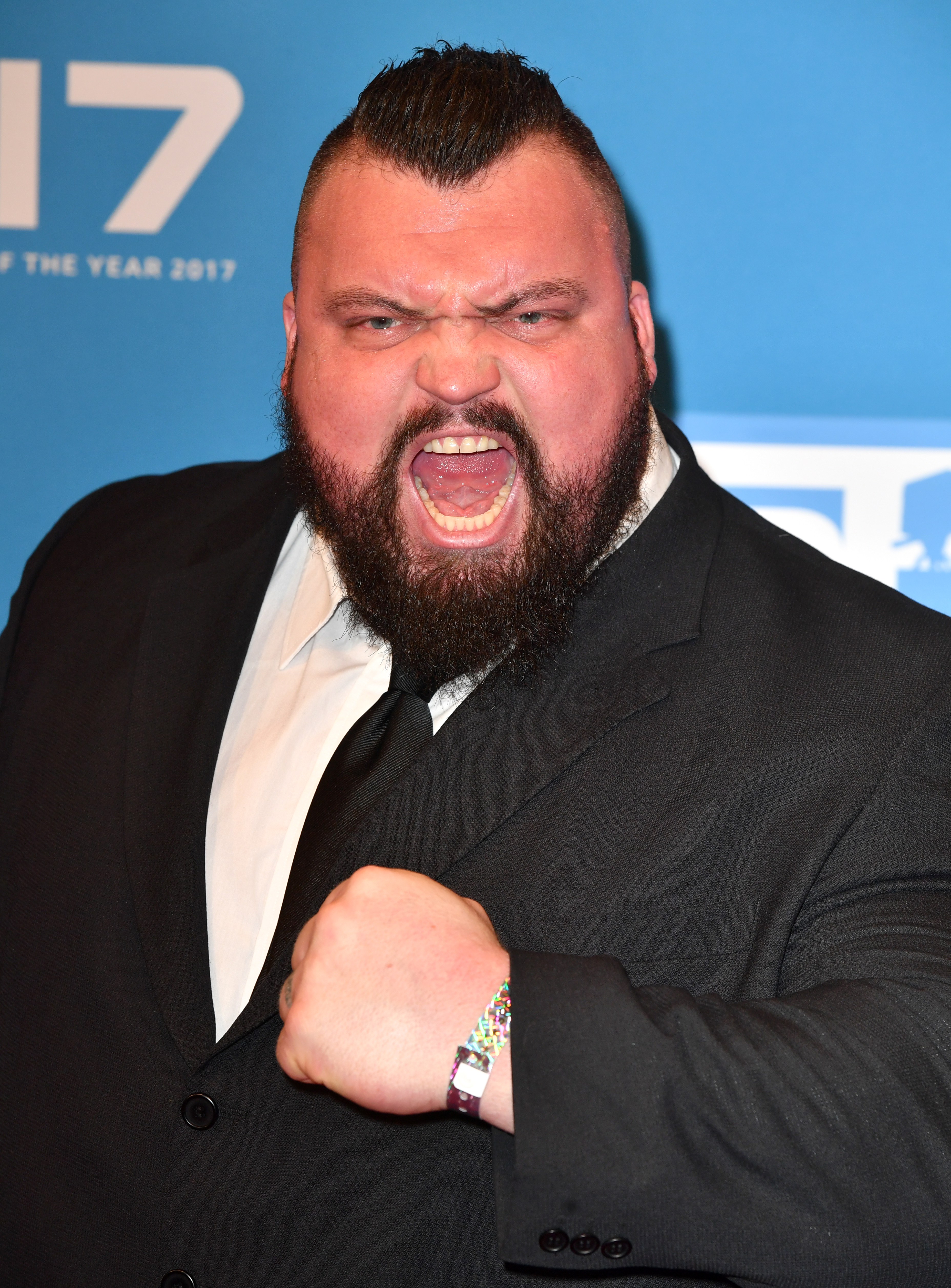 Eddie Hall Reveals The Worst Injury He Has Ever Suffered