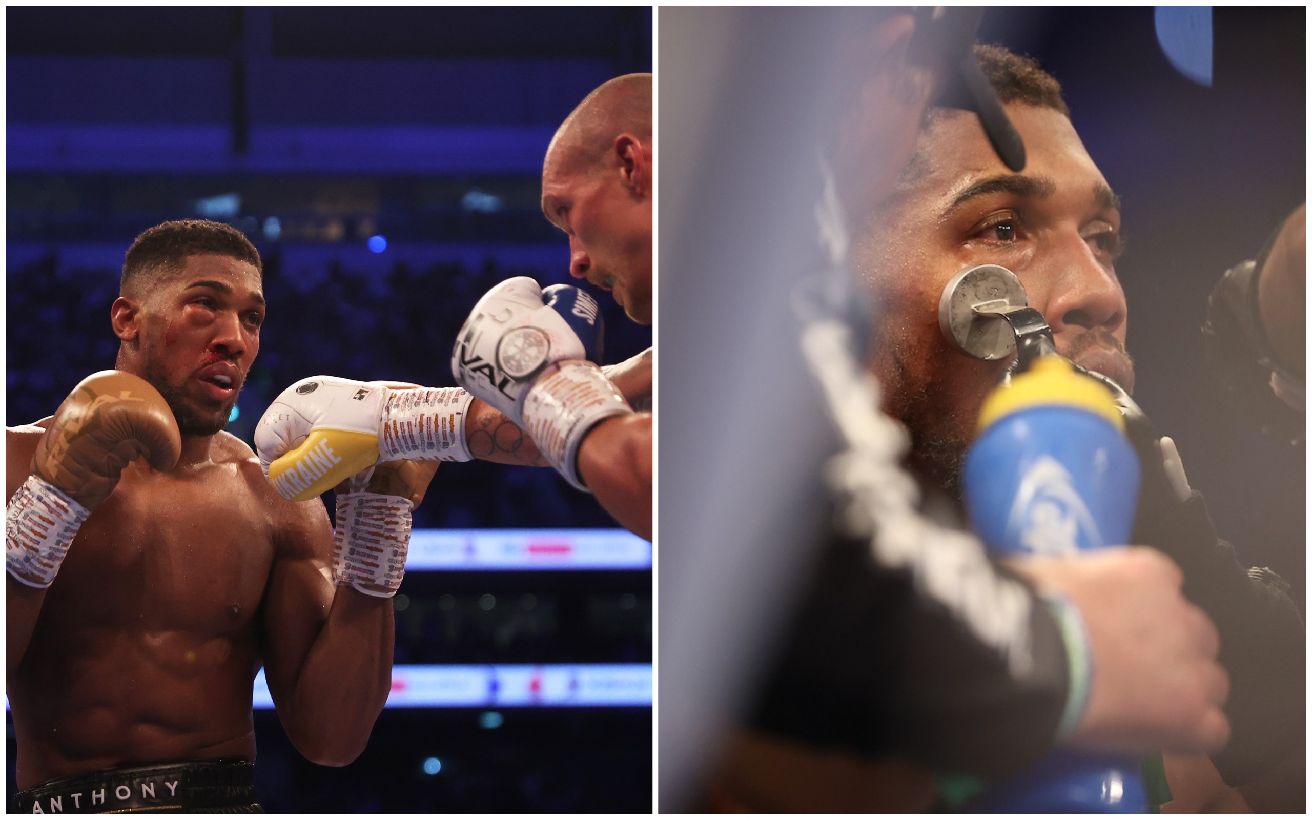 ‘It doesn’t look great’ – Eddie Hearn confirms Anthony Joshua has been taken to hospital with eye injury