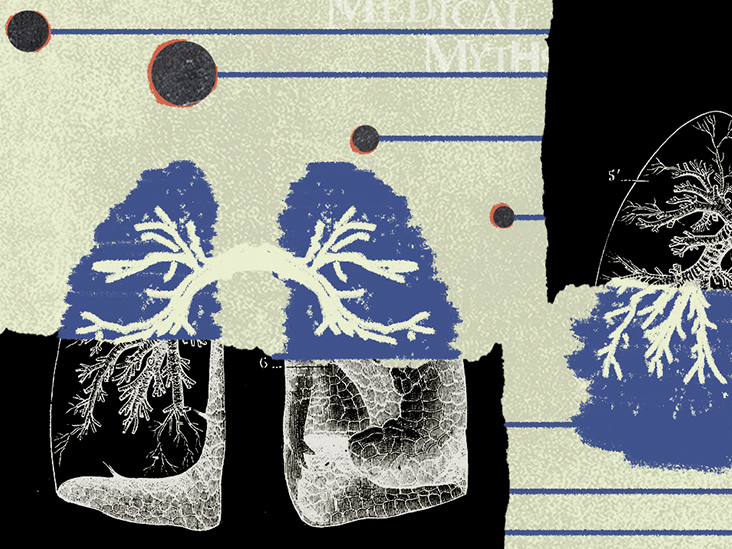 13 myths about lung cancer