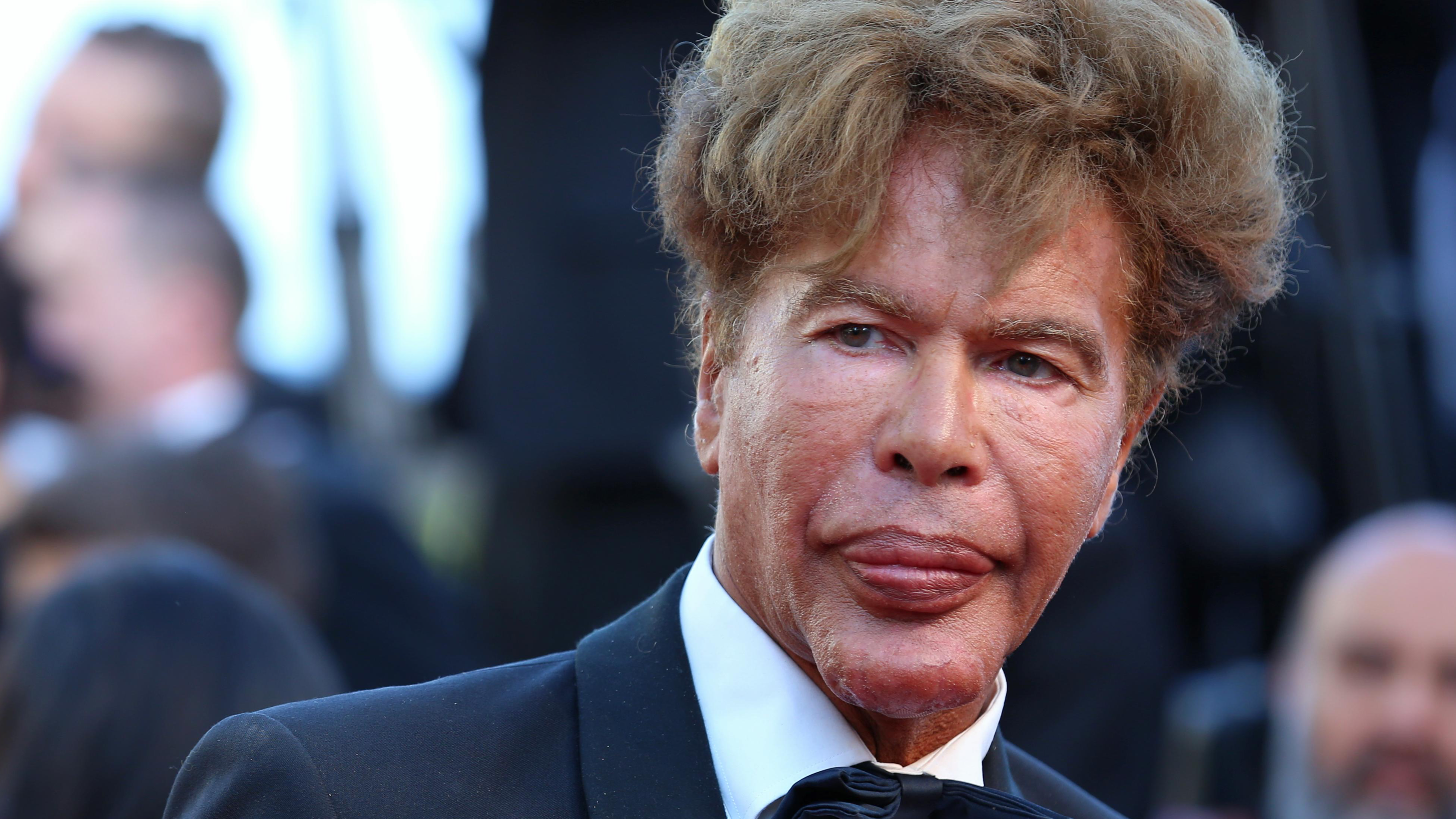 French TV Star Igor Bogdanoff Dies Six Days After Twin Brother
