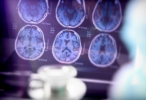 Clearance of protein linked to Alzheimer's controlled by circadian cycle