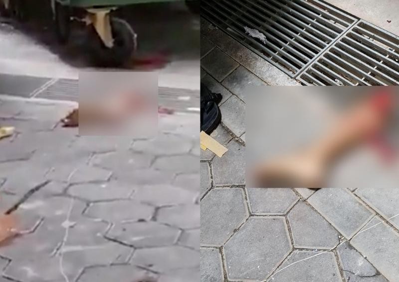 Severed leg found at Margaret Drive in viral video is real, police confirm