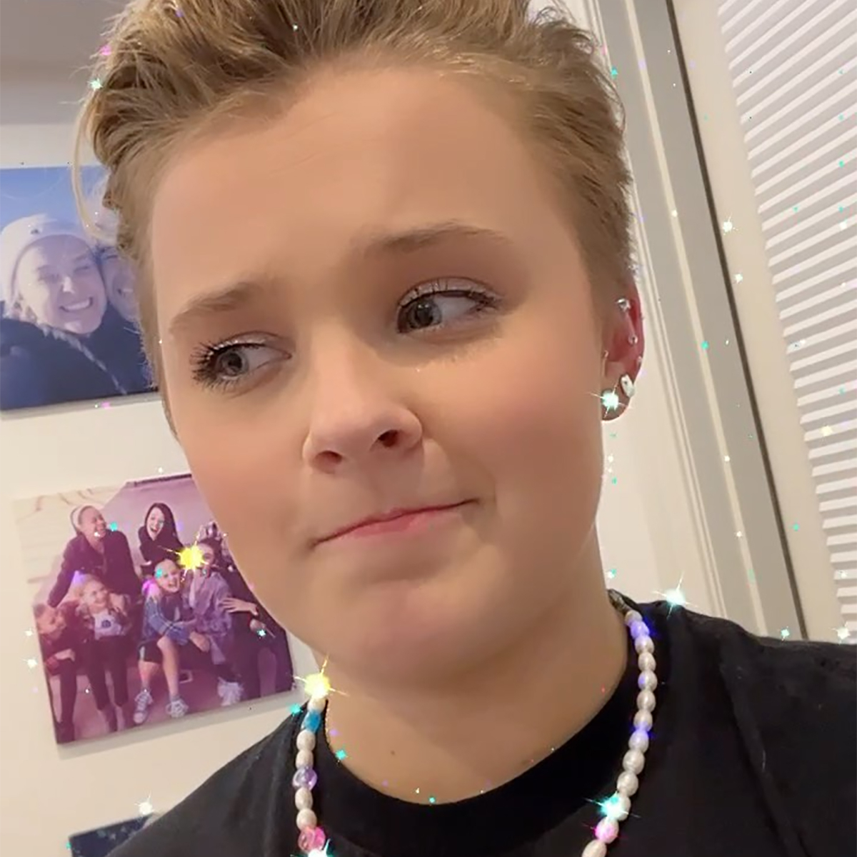 JoJo Siwa Reveals “Bald Spot” and Stress Rash From Dance Moms Days