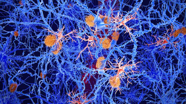 Alzheimer's Brain Barrier Theory Could Open Up New Treatment Paths