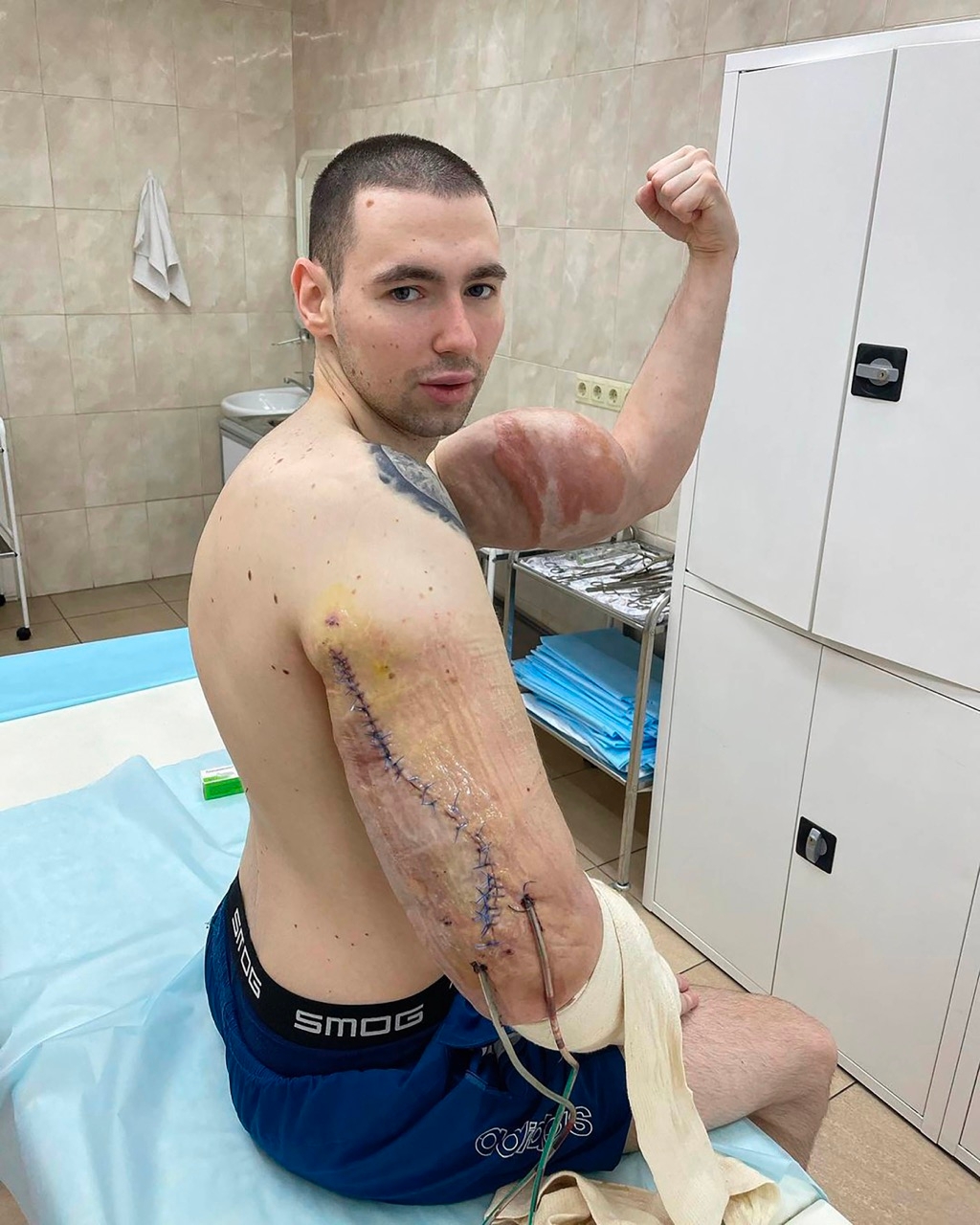 Russian Popeye Ignores Doctor's Death Warnings To Undergo Surgery To Look Like An 'Alien'