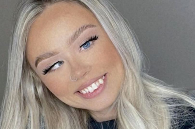 'I'll never get surgery for 'lazy eye' - I feel sorry for those who make cruel comments'
