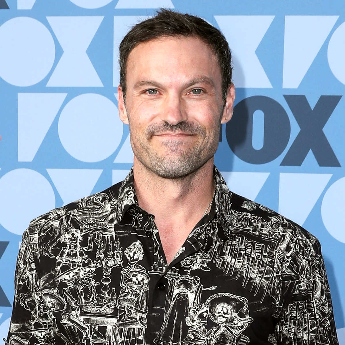 Brian Austin Green's Ulcerative Colitis Explained by a Gastroenterologist