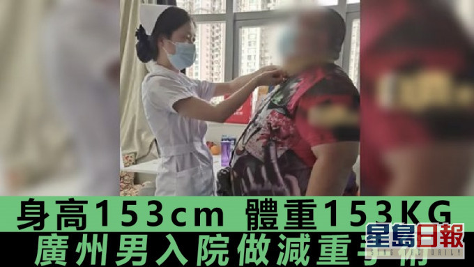 身高体重都是「153」 广州可乐男做手术减肥