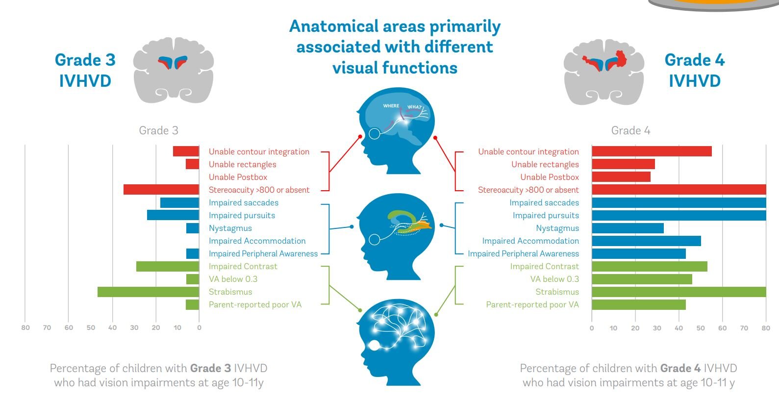 brain-bleeds-in-babies-first-year-can-lead-to-long-term-vision