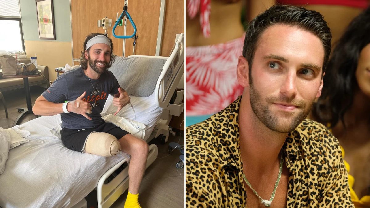 Bachelor Nation’s Cam Ayala undergoes leg amputation surgery 20 years after lymphedema diagnosis