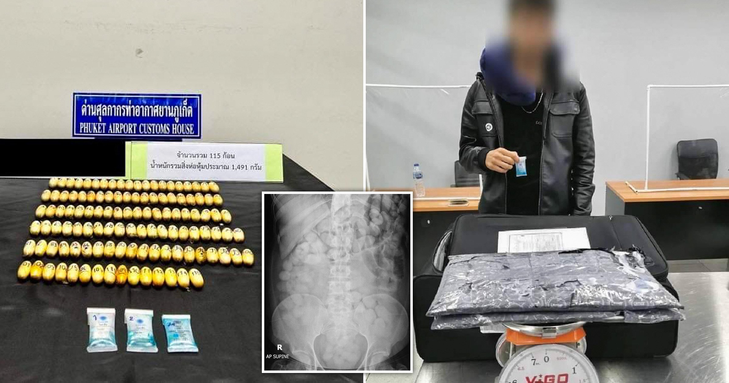 Drug mule stopped at airport with 151 cocaine capsules in stomach