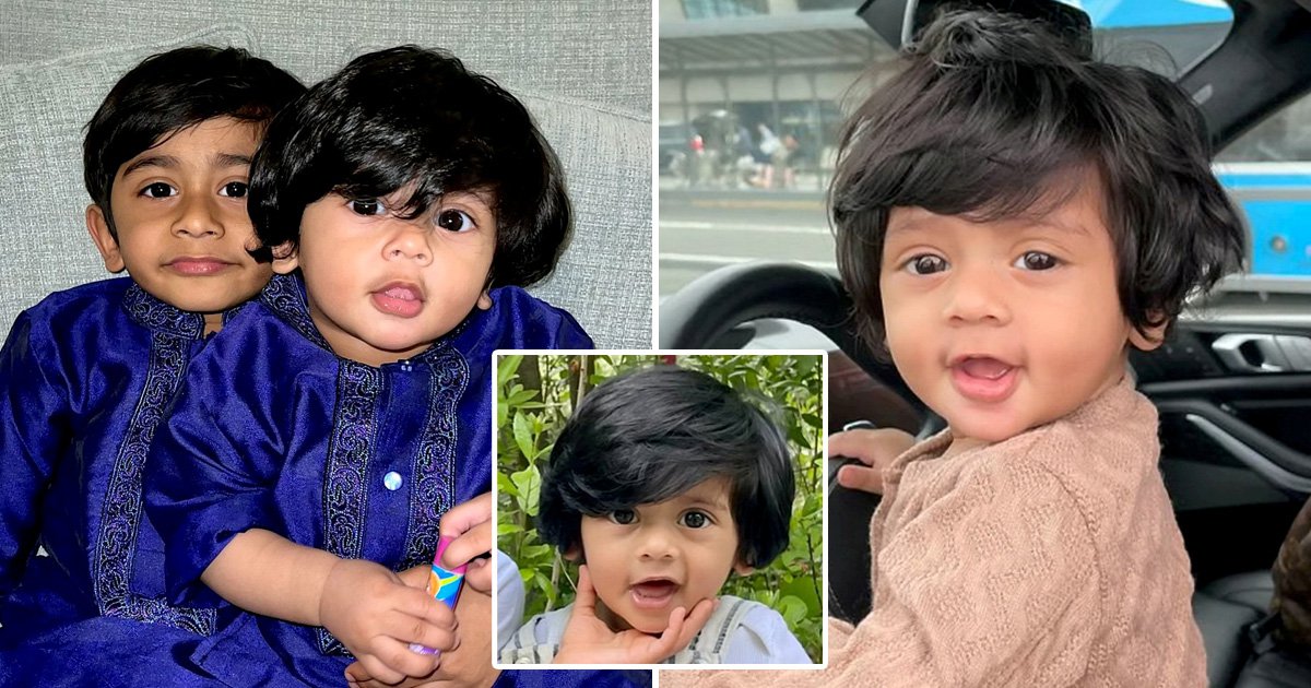 Baby with thick head of hair is often mistaken for wearing a wig