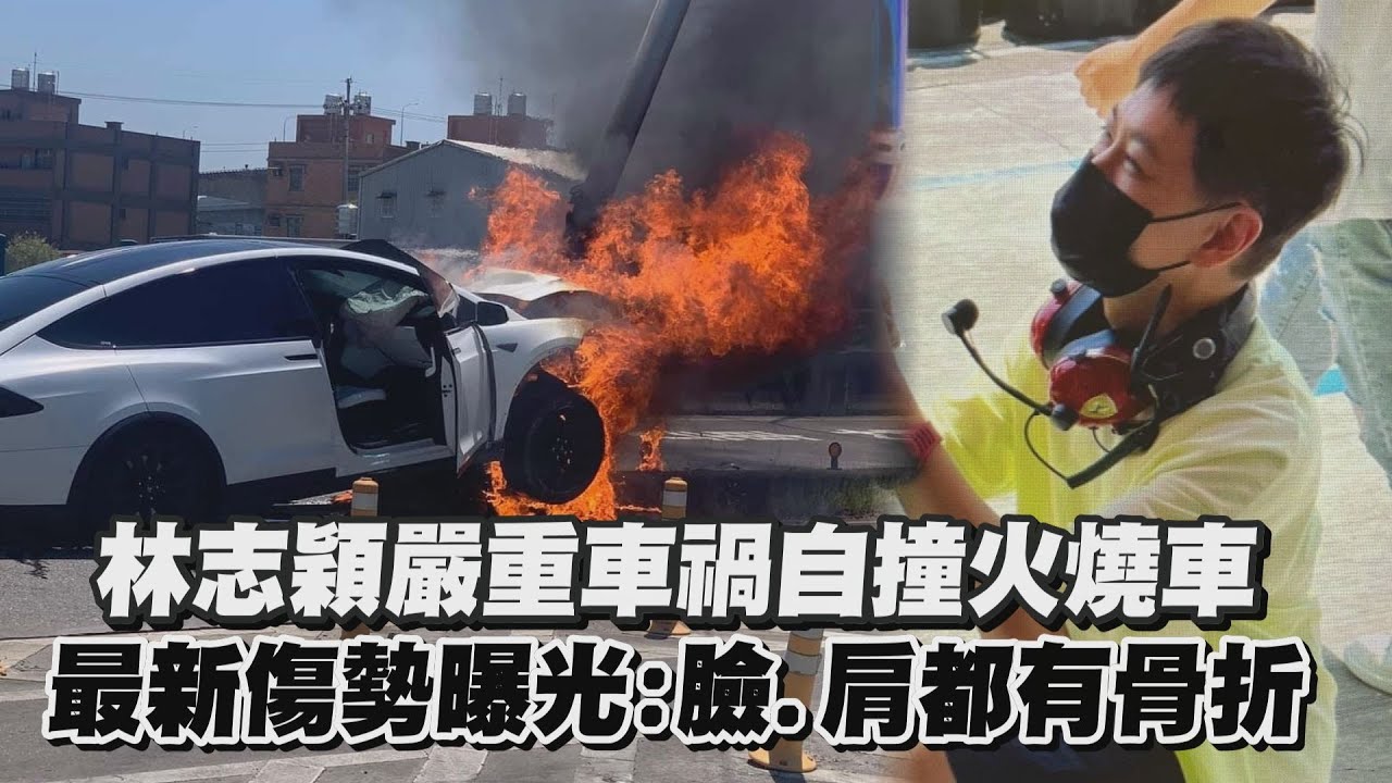 林志颖严重车祸自撞火烧车 最新伤势曝光:脸.肩都有骨折