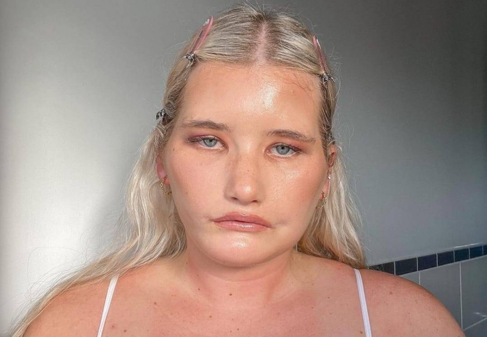 Former NZ Paralympian world record holder with rare neurological