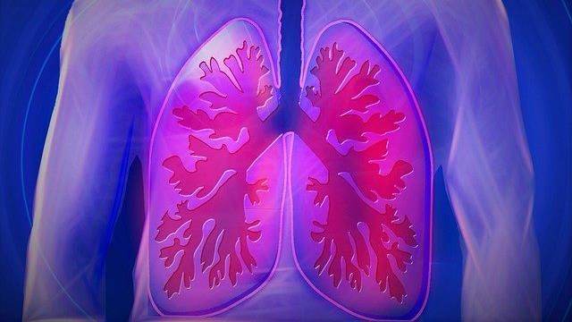 lung-disease-ministry-of-health-and-medical-services