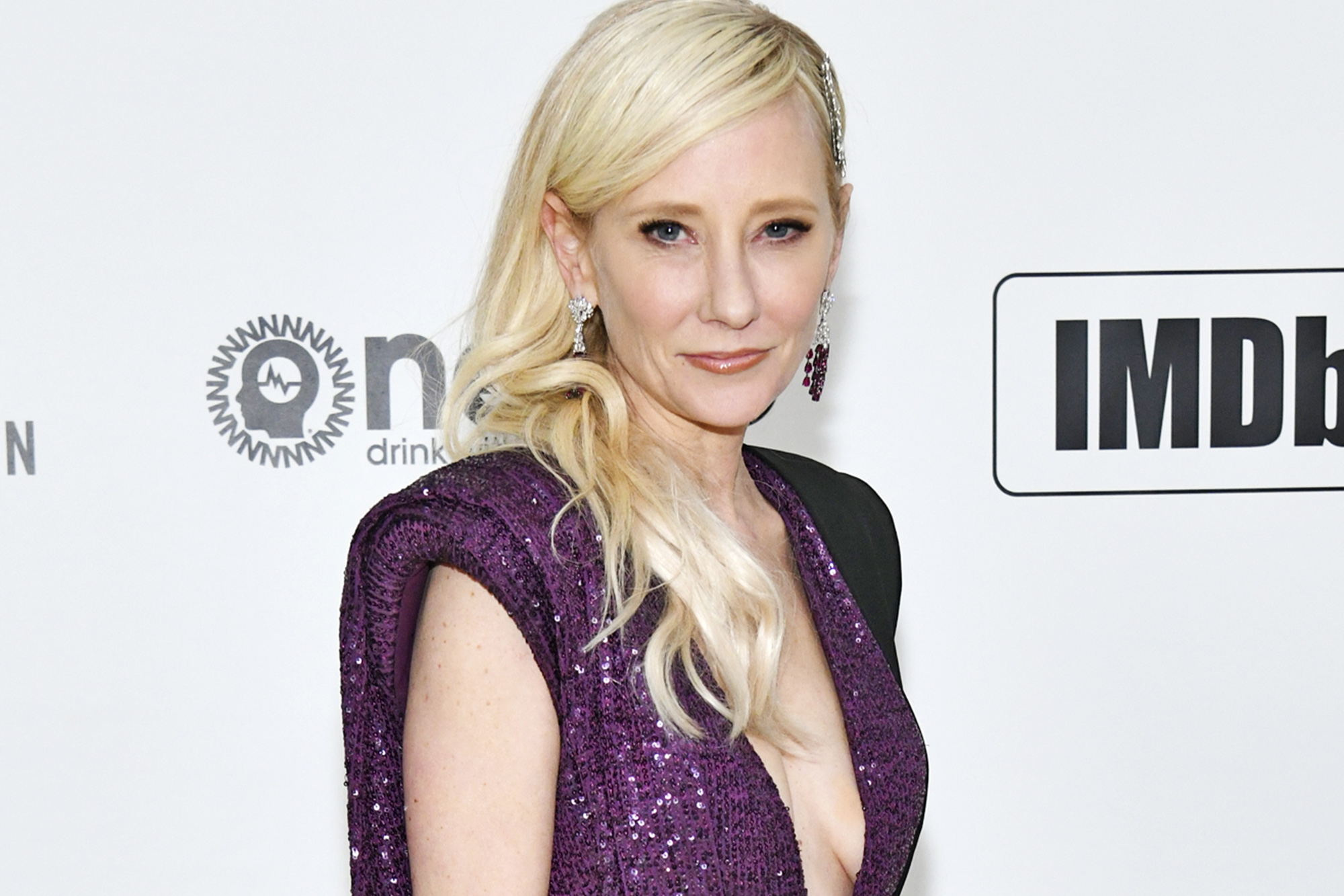 Anne Heche's death was caused by smoke inhalation and thermal injuries, coroner says