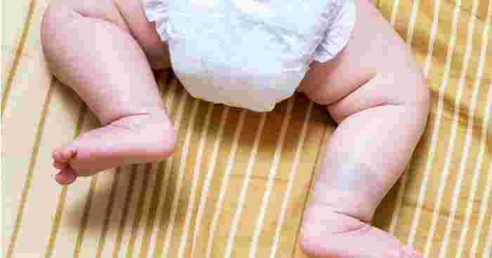 5 Common Types of Birthmarks in Babies