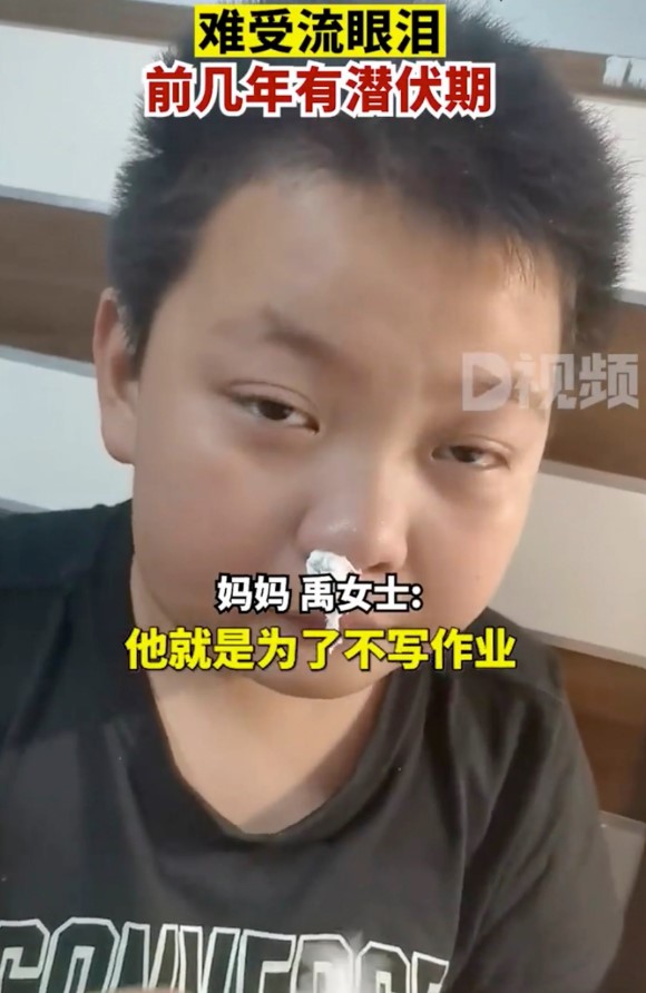 'Homework allergy': Chinese boy's claims reaction takes 5 years to 'incubate' goes viral