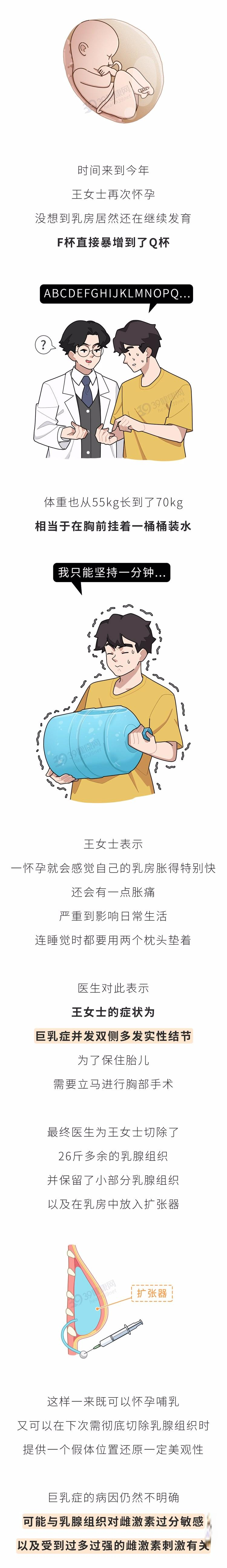 “巨乳症”是什么？女性如何知道自己是否患病？奇怪的知识增加了