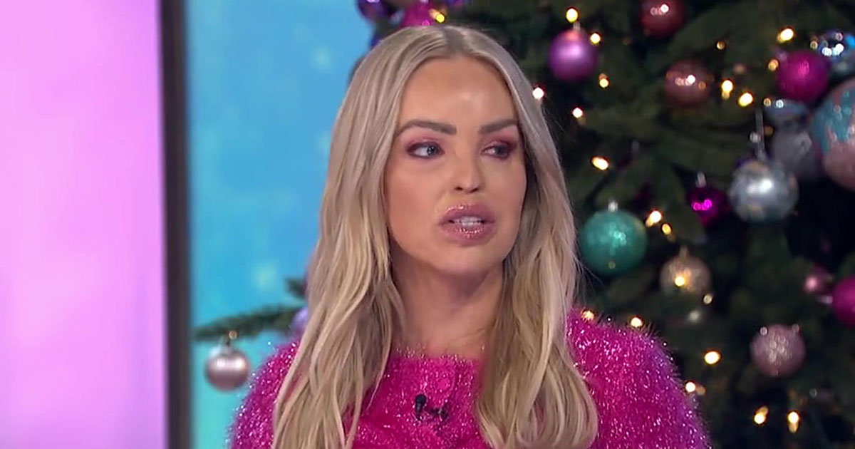 Katie Piper opens up about her 13-hour hair transplant following acid attack: ‘It’s a big deal’