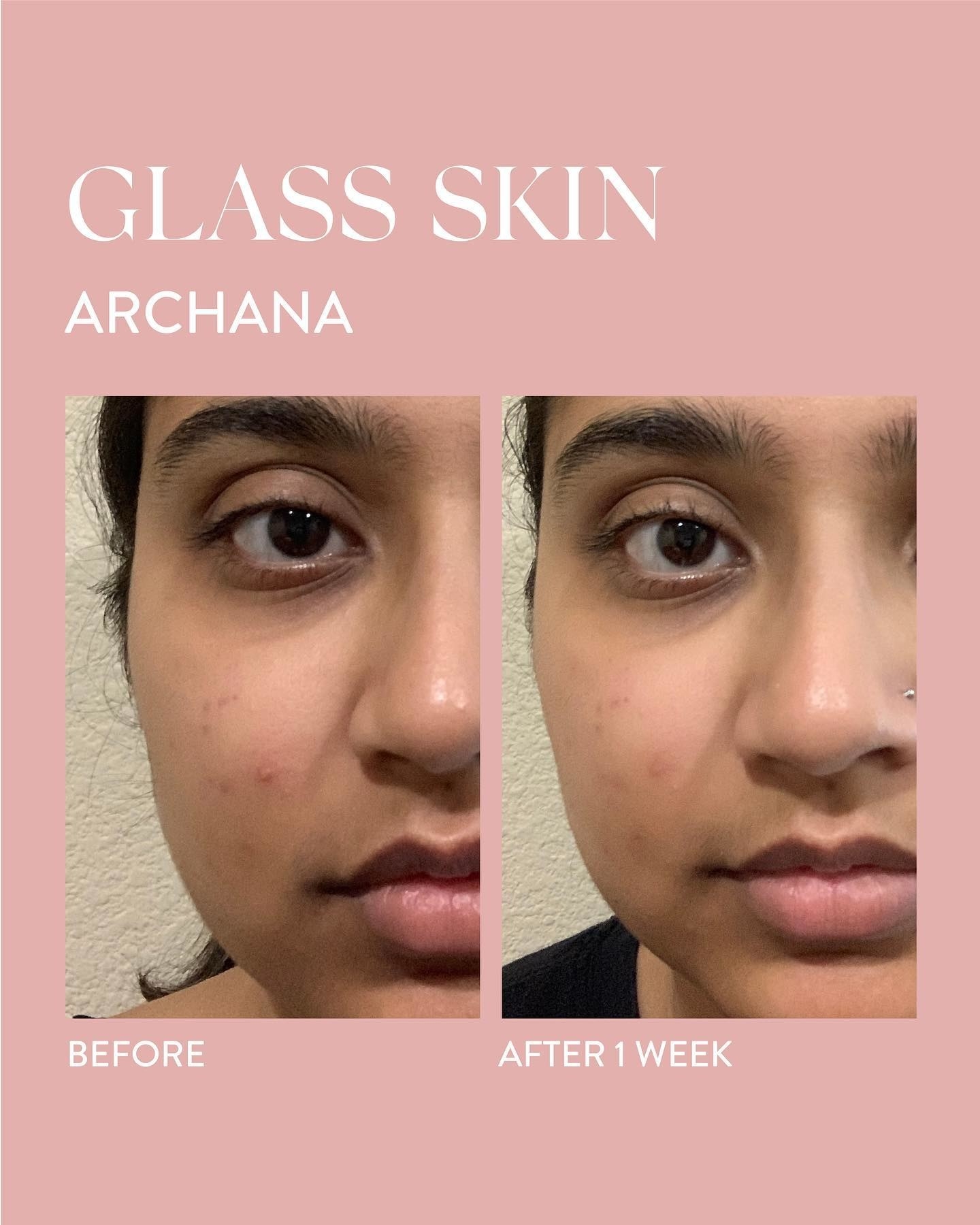 31 Skincare Products With Before & After Photos So Dramatic, We Made Them Click To Reveal