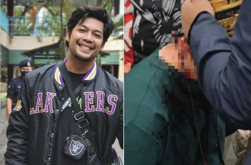 Malaysian actor Kamal Adli attacked at Singapore fan meet: 'Blood was pouring out'