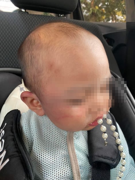 孩子在保姆家跌倒 父母报警 总检署：无虐待 无需跟进
