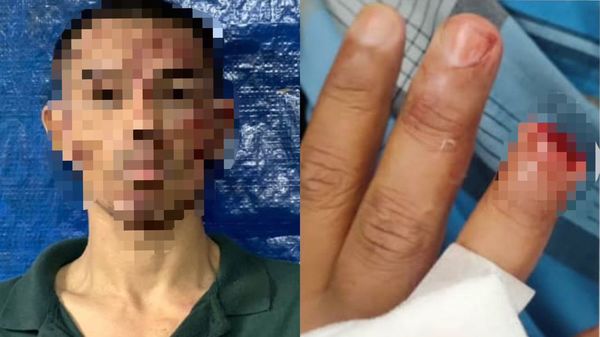 34-Year-Old Man Bites KL Cop's Finger After Threatening To Throw Acid At Him