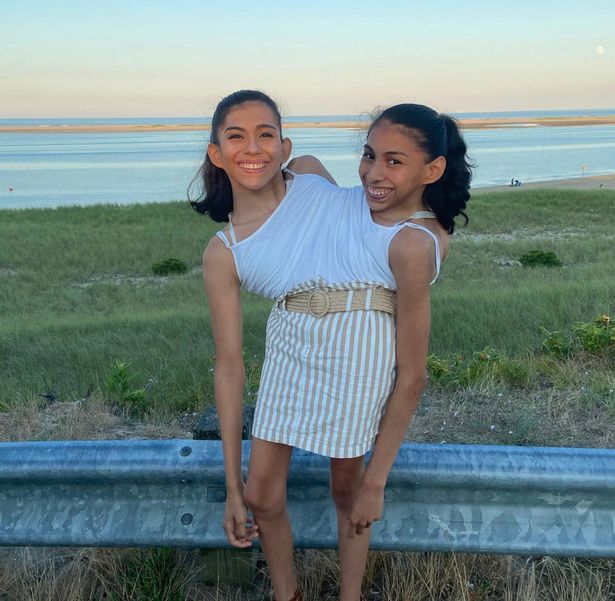 We're 22-year-old conjoined twin sisters attached at the torso and one of us is dating