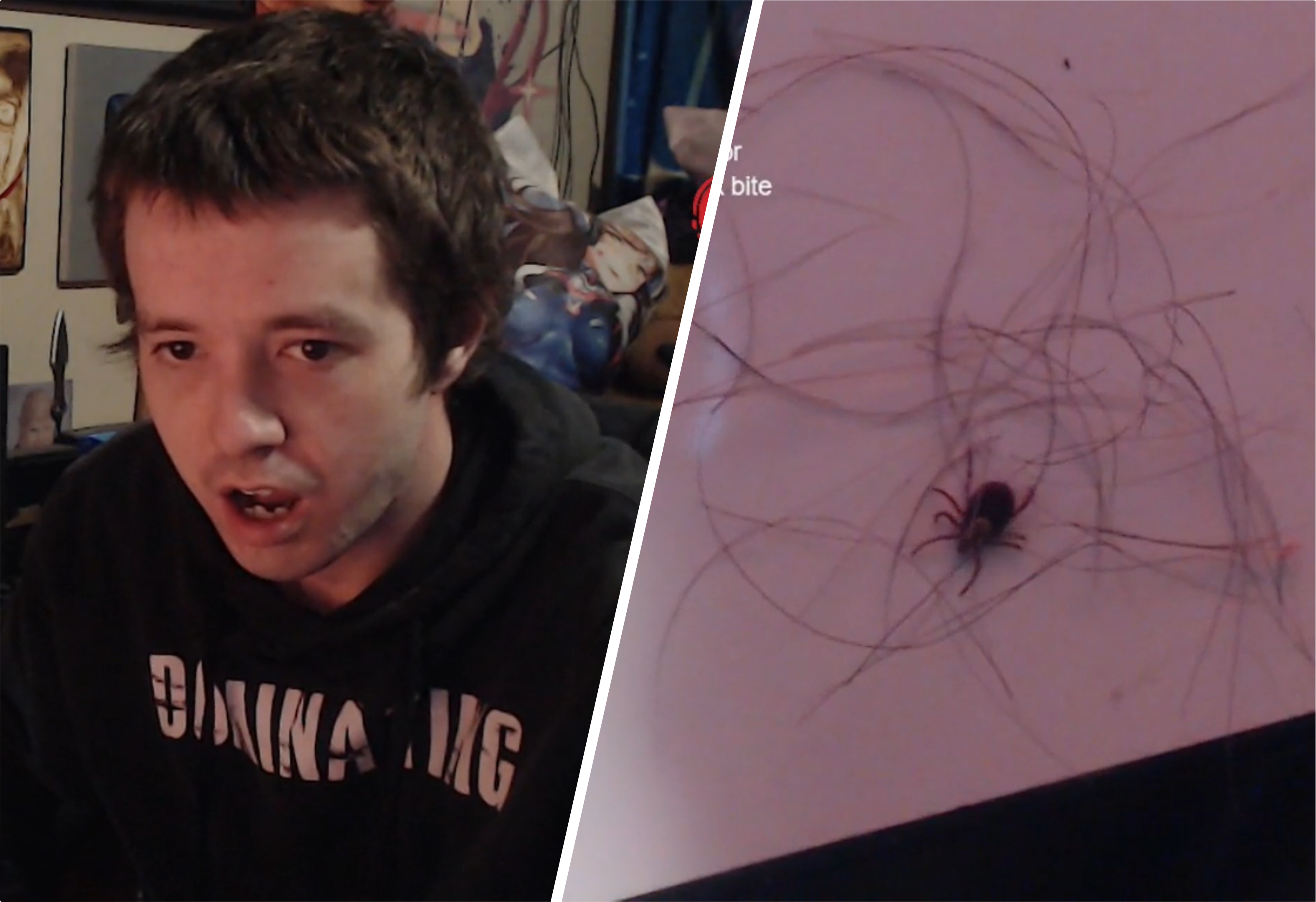 Twitch streamer finds live tick in his hair in front of thousands of viewers