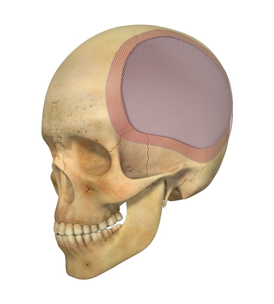 Regrowing the skull bone with 3D printing technology