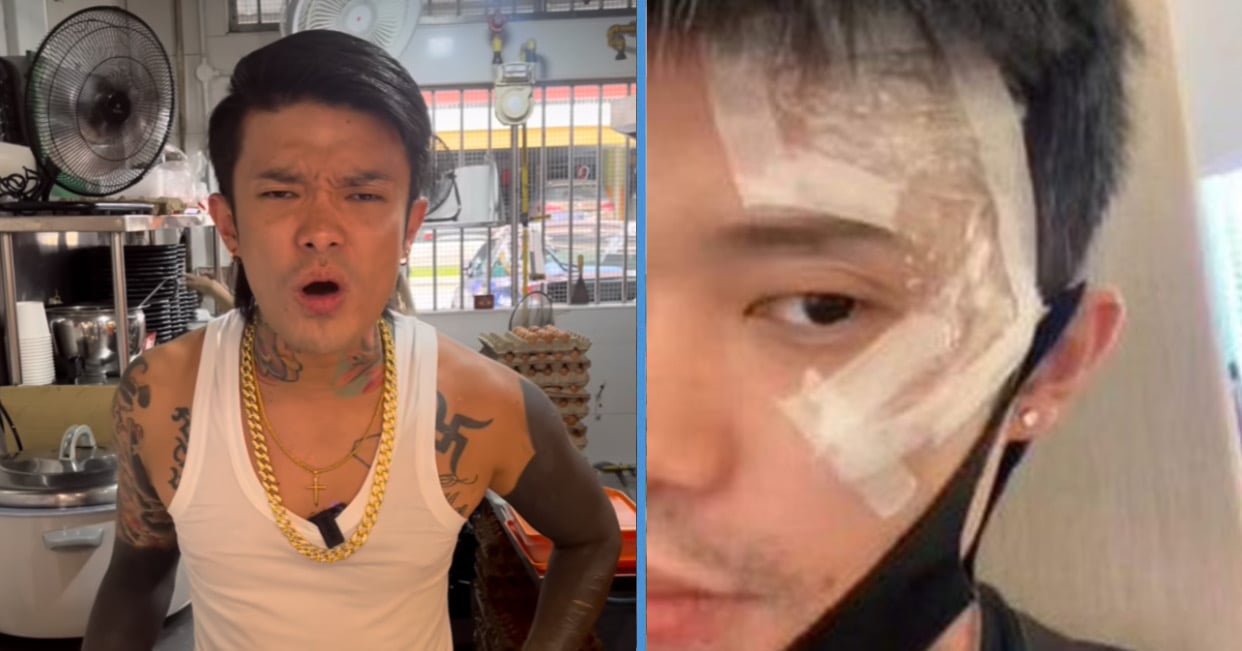 TikTok Sensation Simonboy Had Removed Tattoos on His Face to “Restart” His Life