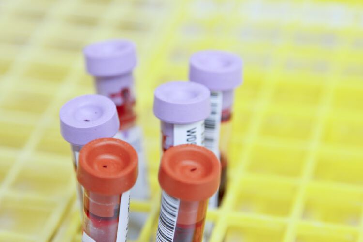 blood-test-that-can-detect-over-50-types-of-cancer-shows-promise-in