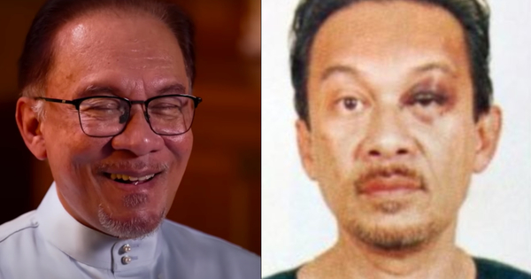 Anwar Recalls The 'Black Eye' Incident In 1998 & How He Thought He Was Going To Die