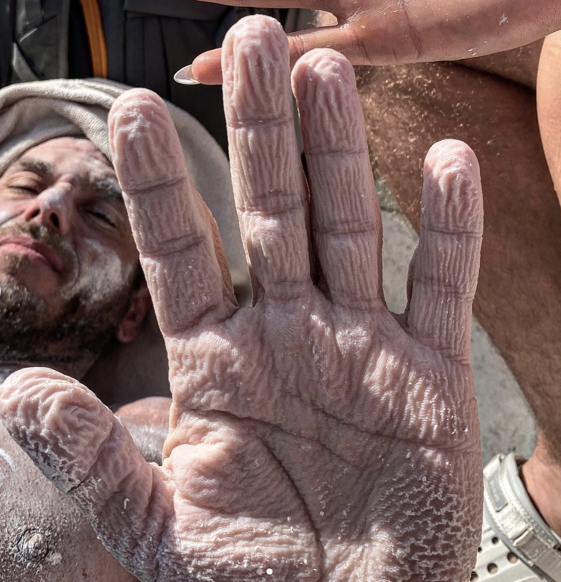 Shocking photos show what attempting world record swim did to man’s body