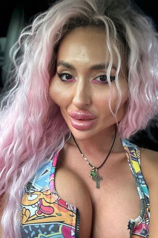 Woman with 'world's biggest cheeks' shows natural look at age 18 before surgery
