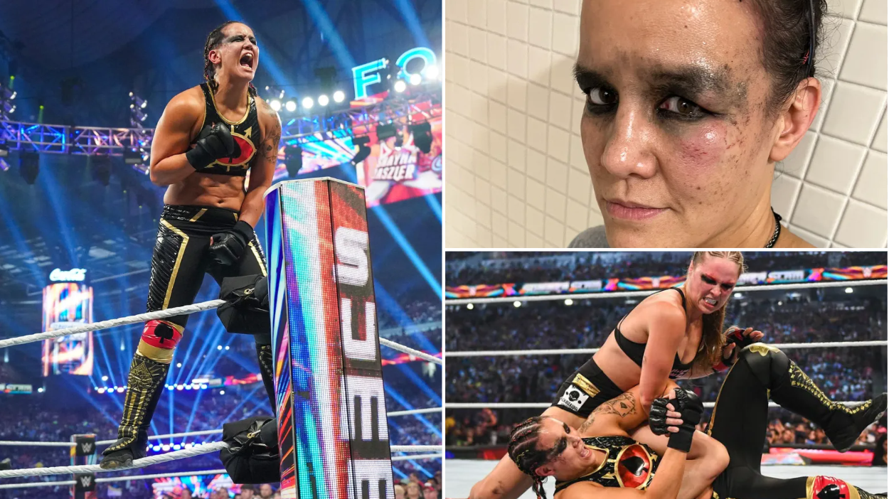 WWE star Shayna Baszler reveals brutal injuries as she sports arm brace and swollen eye after SummerSlam