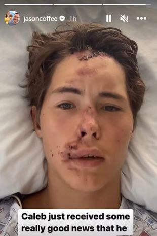 TikTok star in 'excruciating pain' after falling 80ft onto scorching Hawaii lava rocks