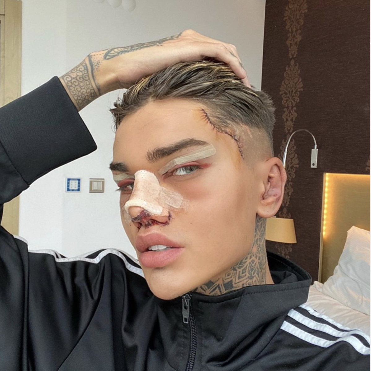 TikToker Levi Jed Murphy Reveals His Favorite Part of “Extreme” Plastic Surgery Is “Getting Content”