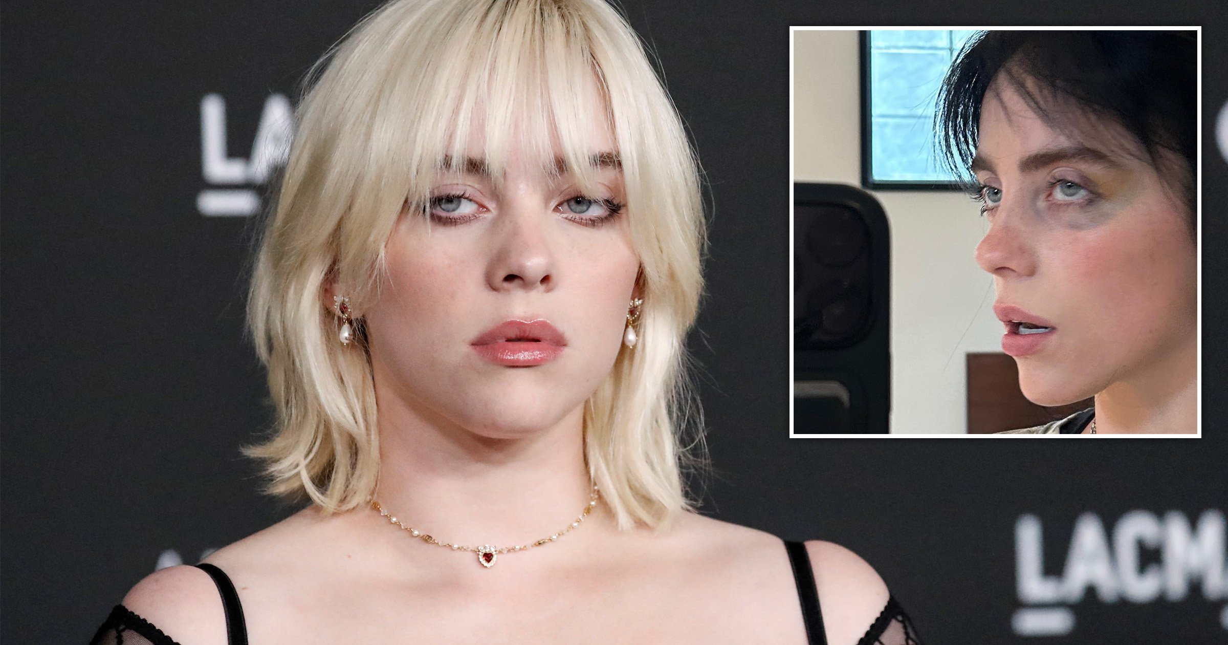 Billie Eilish fans concerned as she appears with black eye