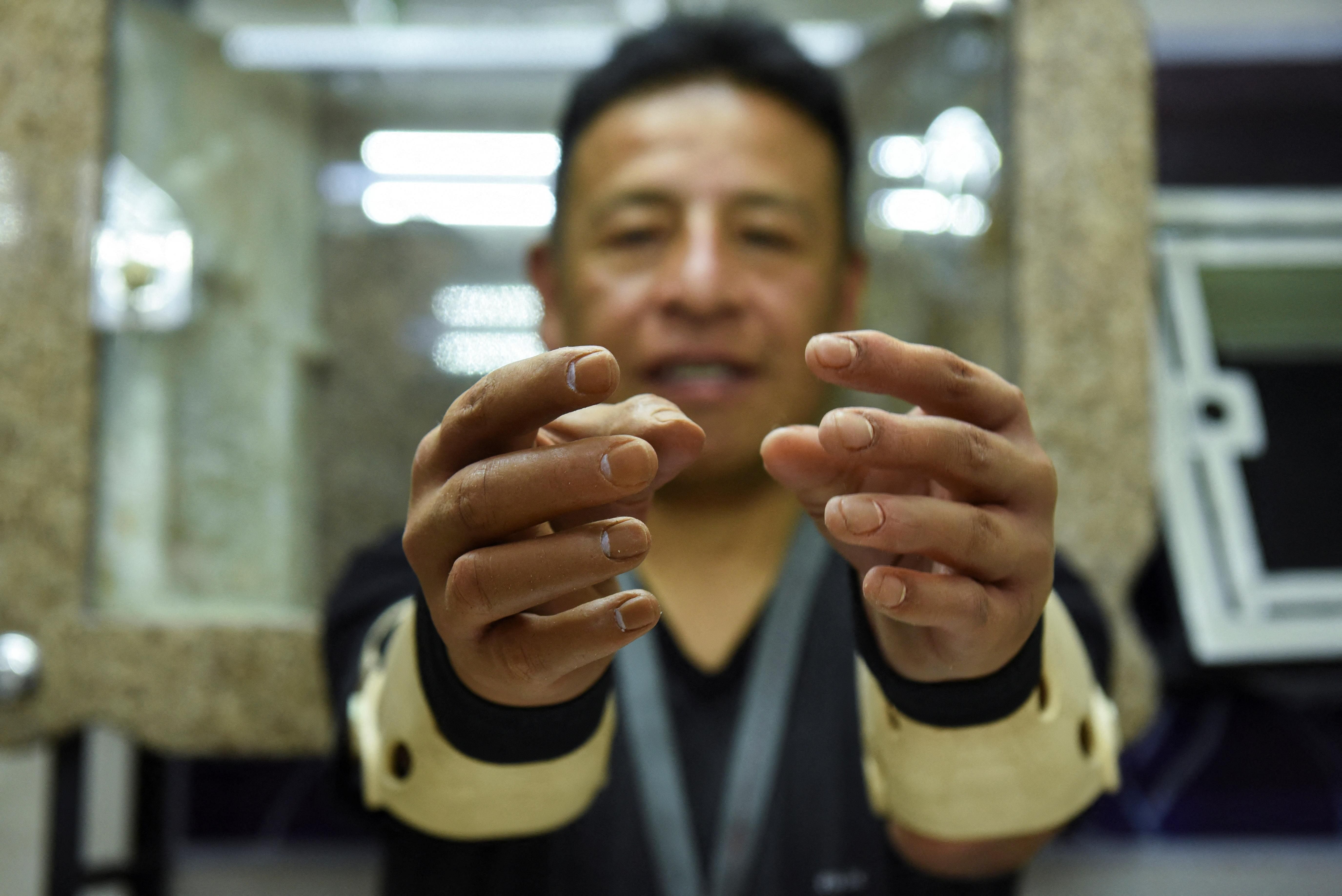 In Bolivia, amputees strap on hyper-realistic prosthetic limbs