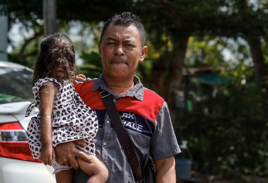 Father of child with 'werewolf syndrome' cherishes King's advice