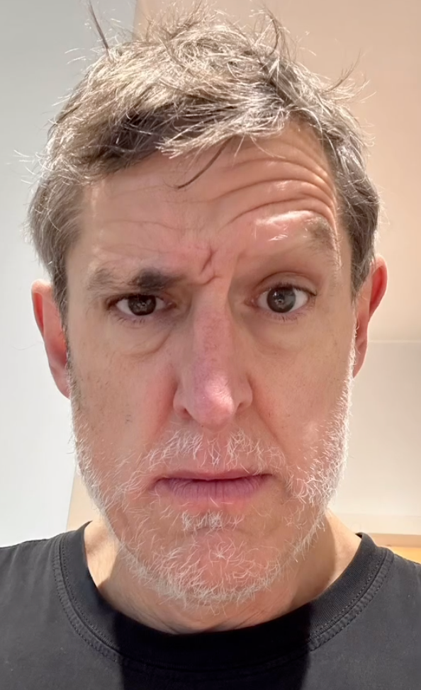 Louis Theroux asks fans for help as he shows changing face from alopecia battle