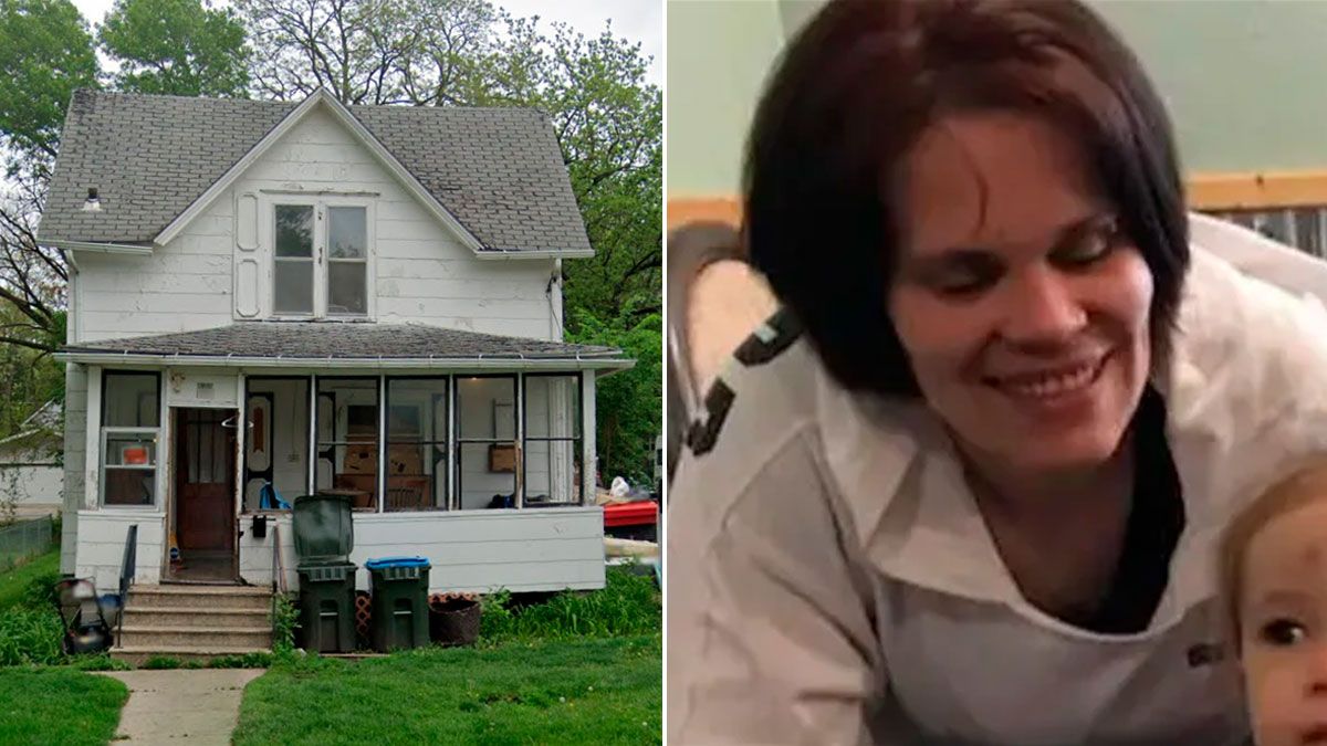 Mum has both legs amputated after being brutally mauled by three pit bulls