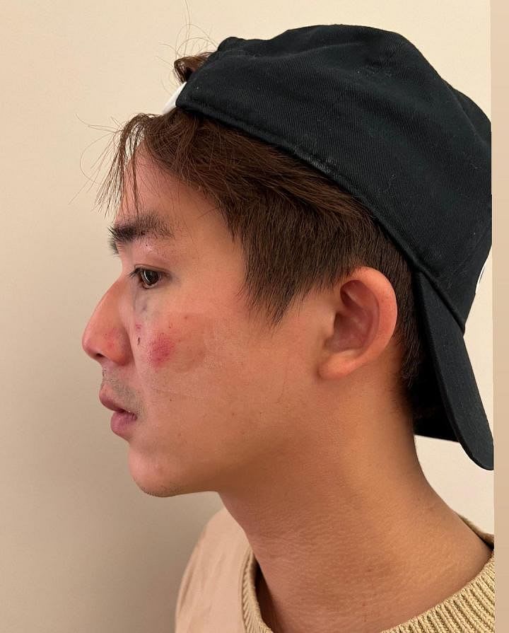 The Diam Diam Era Star Danny Lee Gets Into Altercation With Stranger After Walking Straight Into Latter's Car Wing Mirror While Drunk